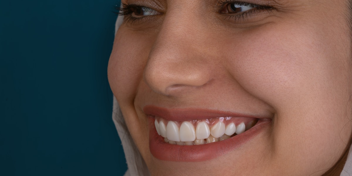 Happy patient with healthy smile representing dental implant treatment and insurance coverage options for tooth replacement